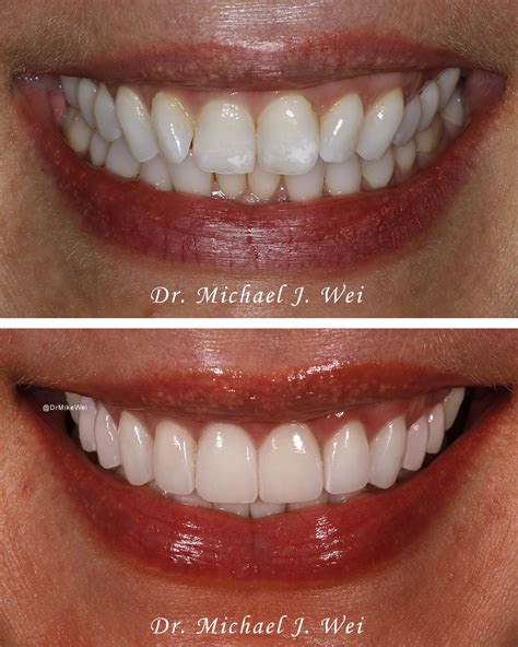 10+ Dr Finegold Nyc Secrets For Perfect Teeth