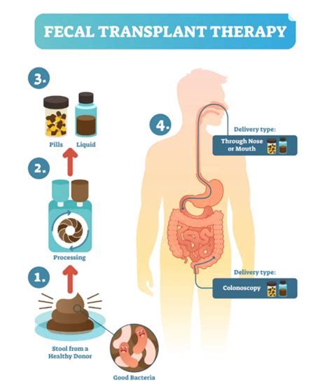 12 Transplant Quality Institute Tips For Better Outcomes