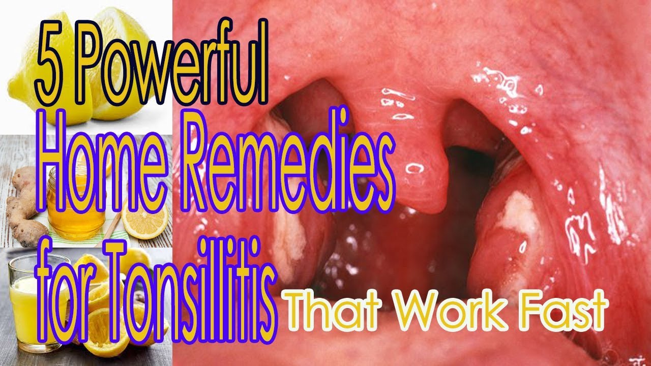 7 Home Remedies For Swollen Feet That Work Youtube