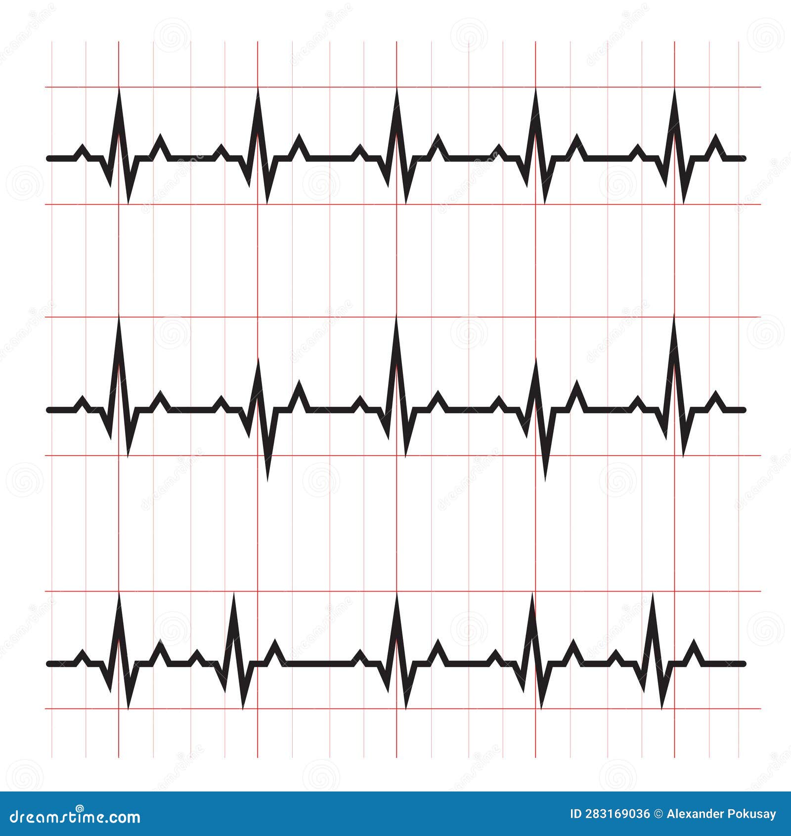 Abnormal Cardiogram Results