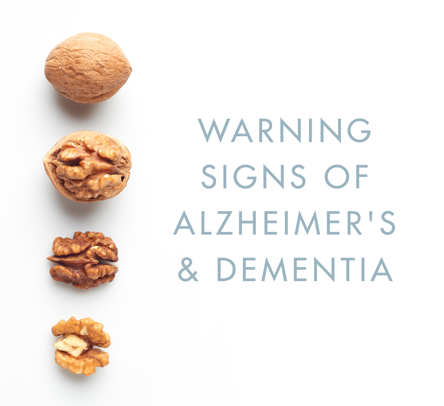 Alzheimer S Disease Warning Signs Symptoms Research Dw