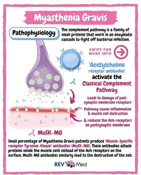 Dr Shrooqhawati On Twitter Myasthenia Gravis Summary Foamed Foamcc