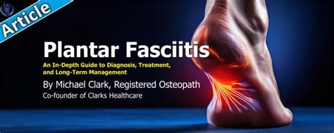 Healing Plantar Fasciitis: Longterm Relief Guide