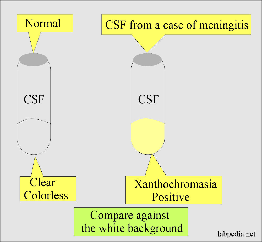 High Rbc In Cerebrospinal Fluid