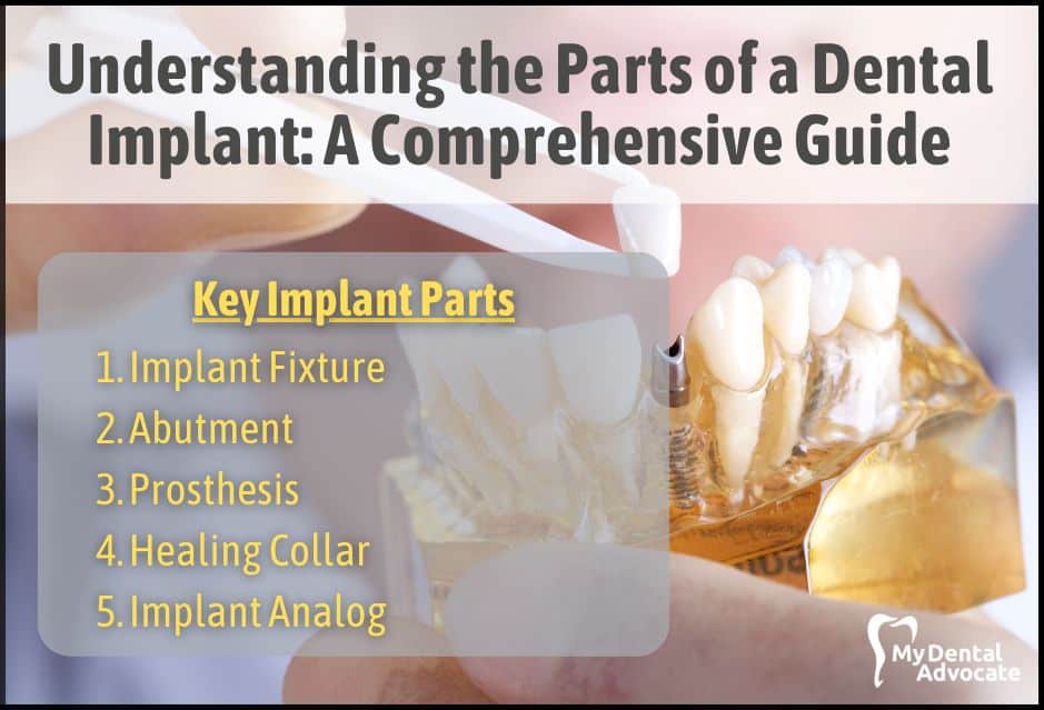 Hip Implant Parts: Comprehensive Guide