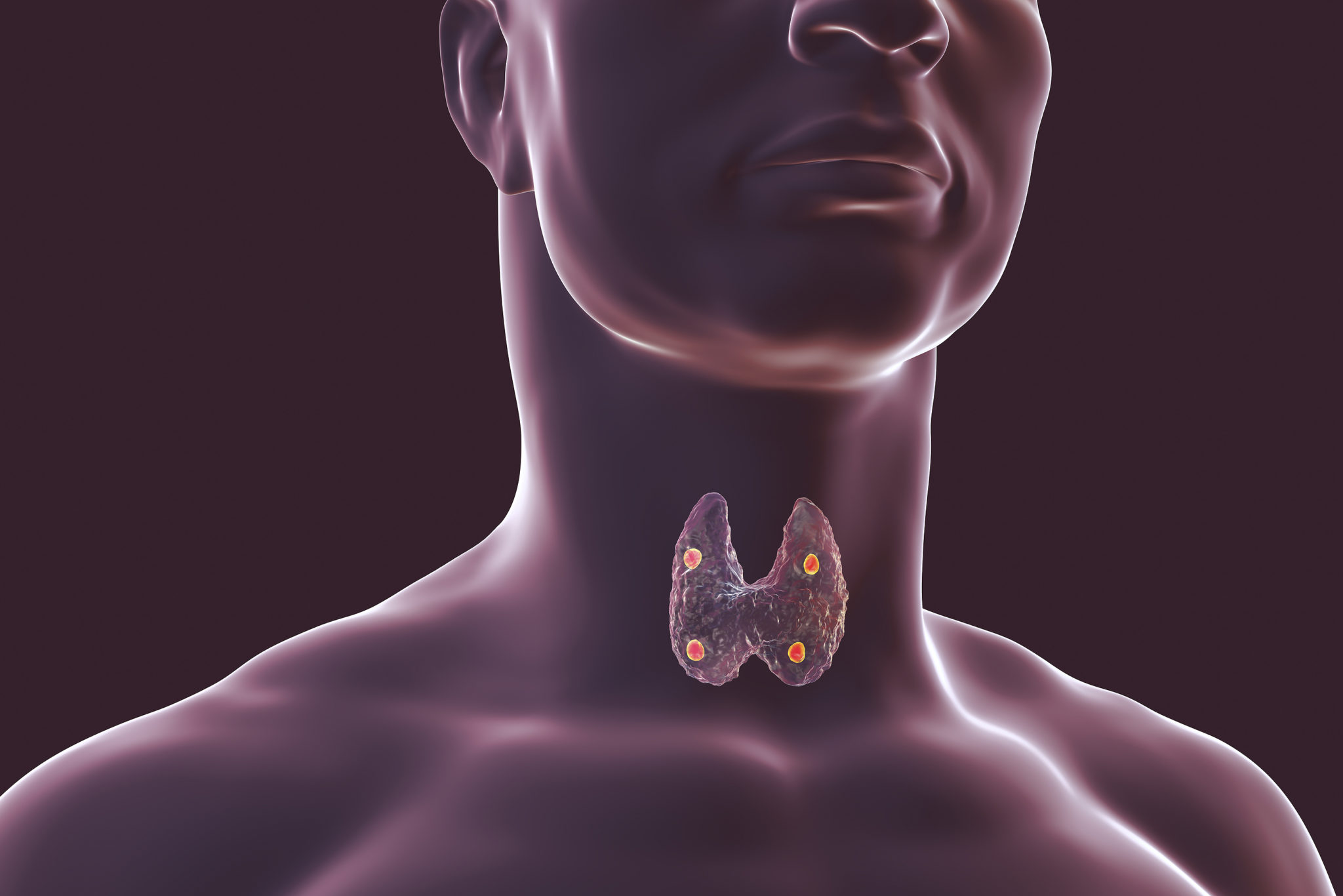 How Long Is Parathyroid Surgery