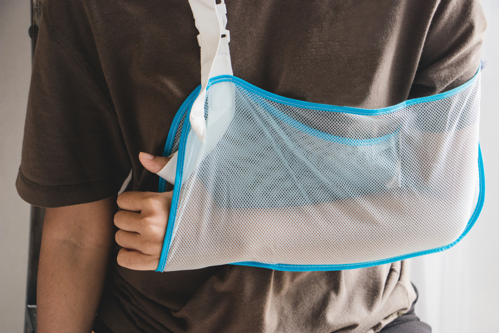 How To Wear A Sling For Rotator Cuff Injury At Marlene Walsh Blog