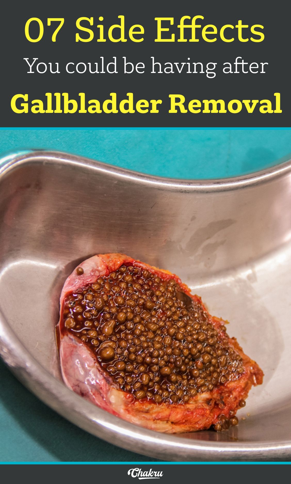 Is Corn Bad For Gallbladder