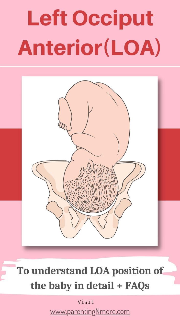 Loa In Medical Terms