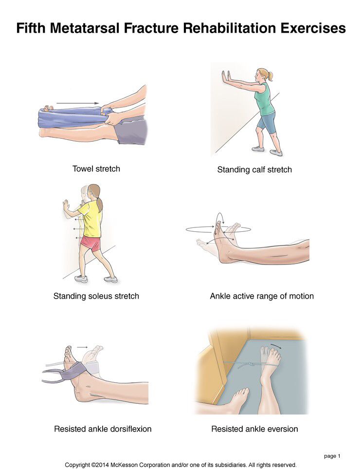 Metatarsal Surgery Healing: Recovery In 6 Weeks