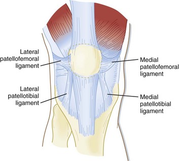 Mpfl Reconstruction And Microfracture Knee Surgery