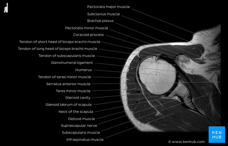 Normal Shoulder Mri How To Read A Shoulder Mri Kenhub