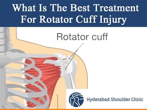 Rotator Cuff Injuries Explained Rotator Cuff Injuries,, 48% Off