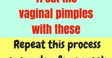 Treat The Vaginal Pimples These Repeat This Process Every Day For A Week Health At Home