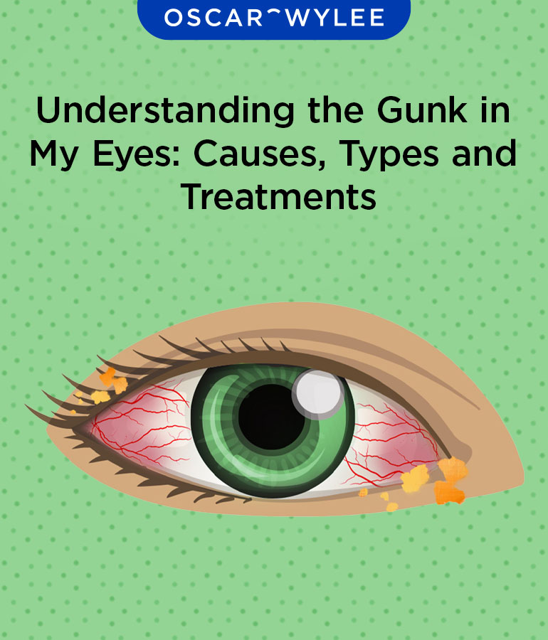 Types Of Eye Mucus, Discharge, And Boogers, 55% Off