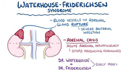 Waterhouse Friderichsen Syndrome Video Causes Meaning Osmosis