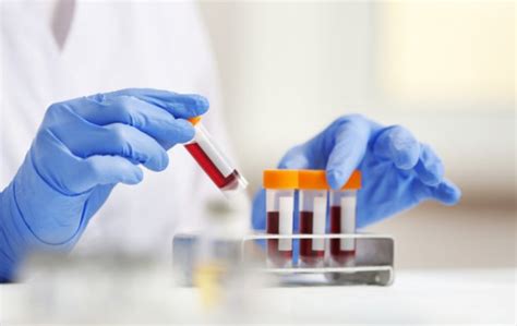 What Is Blood Test Pep? Your Diagnostic Guide